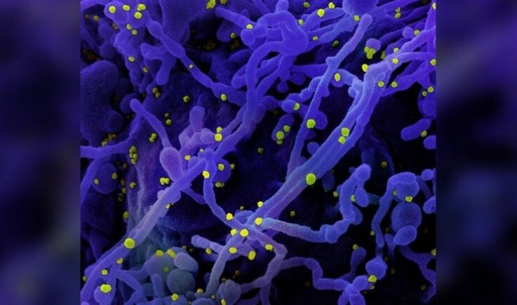 دراسة .. فيروس كورونا يحفز الخلايا المصابة لإطلاق مخالب "شريرة" للانتشار بسرعة عبر الجسم