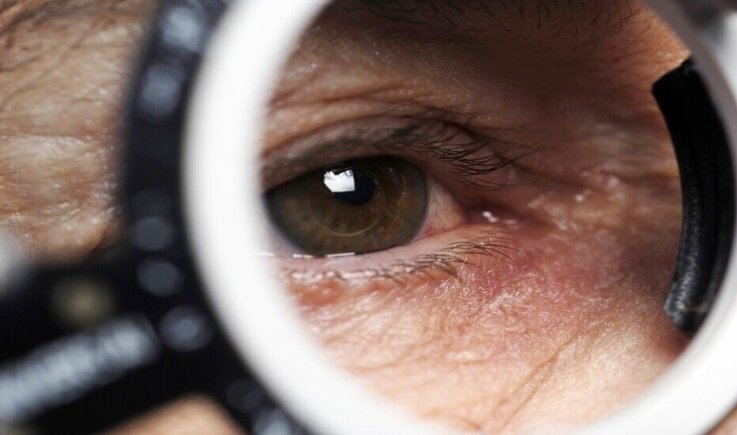 دراسة تقترح العيون الملتهبة من بين أهم أعراض "كوفيد-19"