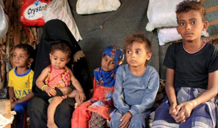  الجوع والمرض يقتلان طفلًا يمنيًا كل 10 دقائق 