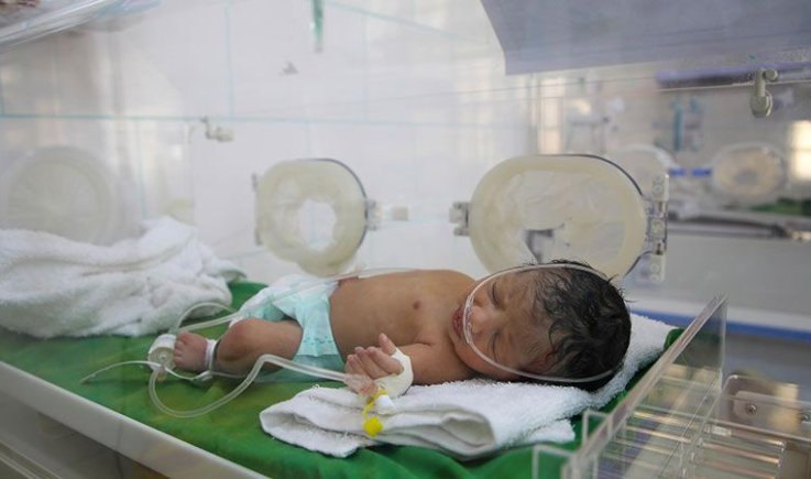 كارثة اطفال اليمن : تشوّهات المواليد سببها الأسلحة السعودية المحرَّمة