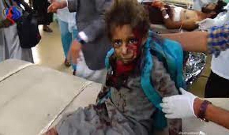 تقرير حقوقي يفضح جرائم العدوان السعودي بحق أطفال اليمن 