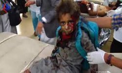 تقرير حقوقي يفضح جرائم العدوان السعودي بحق أطفال اليمن 