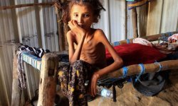 صحيفة أمريكية: أوقفوا دعم بلادنا للأعمال الوحشية في اليمن