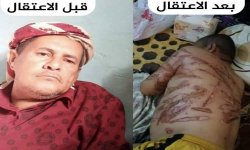 تفاصيل جديدة حول جريمة التعذيب الوحشي بحق المواطن محمد مهدي..